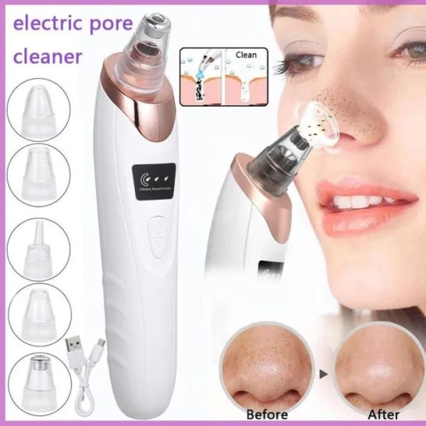Electric Blackhead Remover