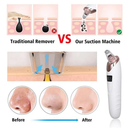 Electric Blackhead Remover